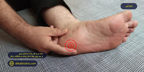cause-swelling-soles-feet