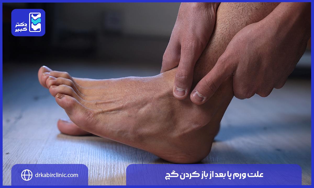 علت ورم پا بعد از باز کردن گچ