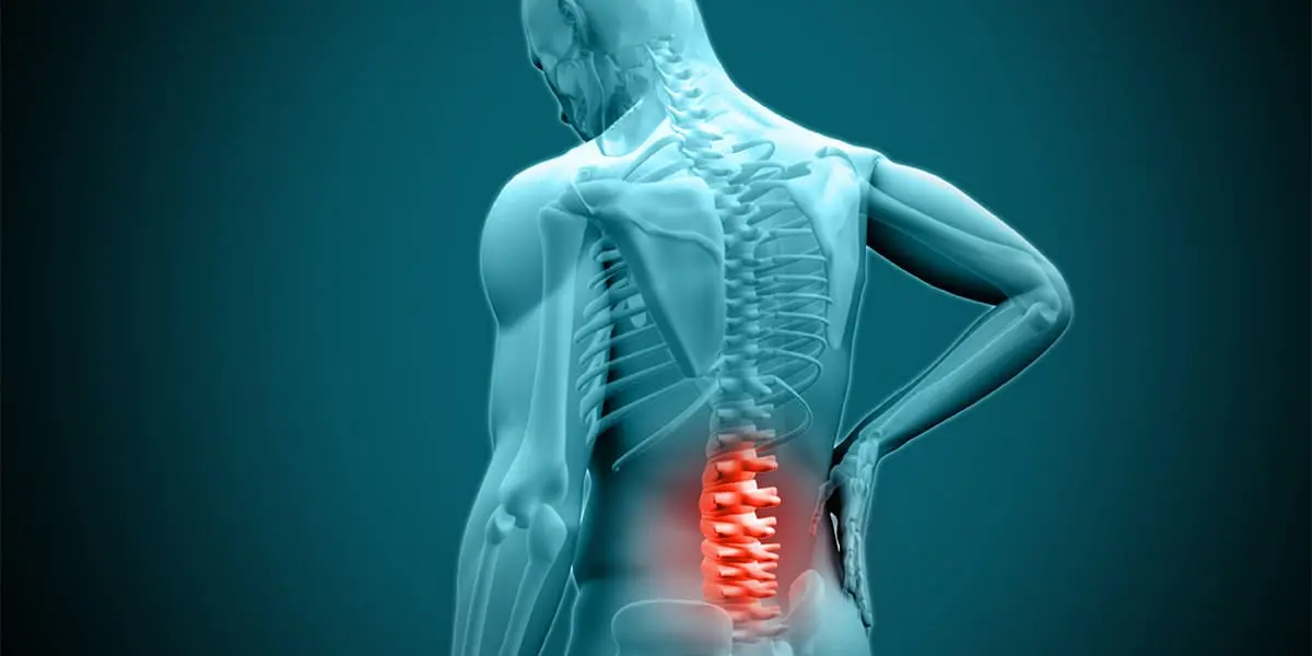 Lumbar-disc-inflammation-pill