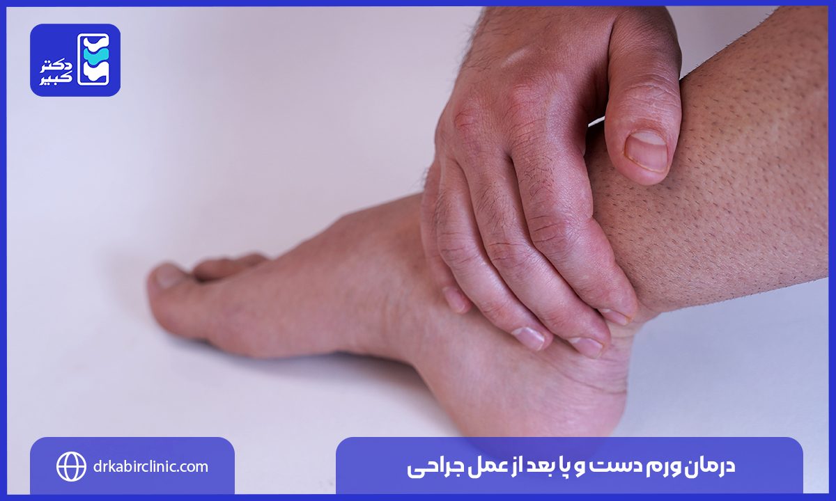 درمان ورم دست و پا بعد از عمل جراحی