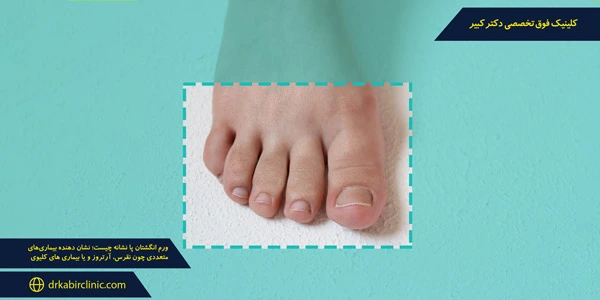 What-symptoms-swollen-toes