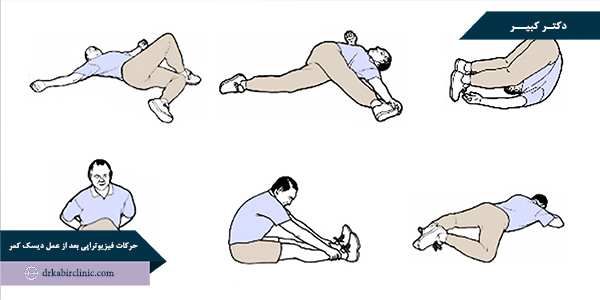 آشنایی با حرکات فیزیوتراپی بعد از عمل دیسک کمر